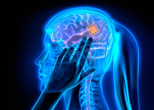 Successful Implant of First Human Brain Chip by Elon Musks Neuralink